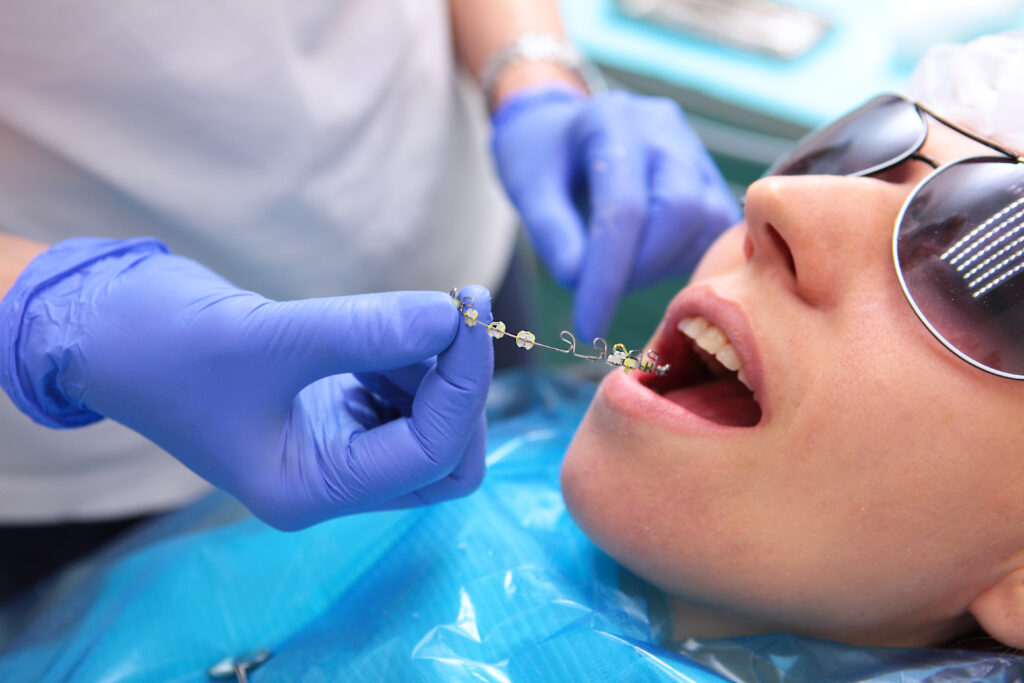 Here’s What Happens at Your Braces Consultation The Braces Guide
